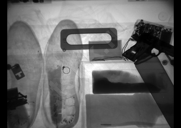 Рентгенотелевизионная установка Калан-2М